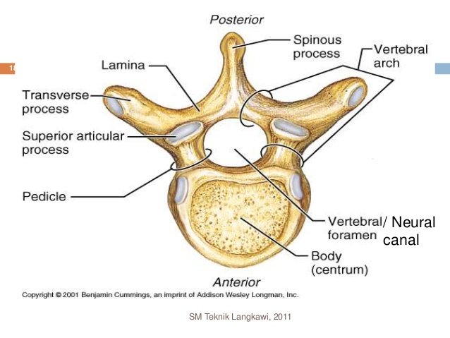 vertebroarterial foramen