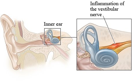 vestibular nerve