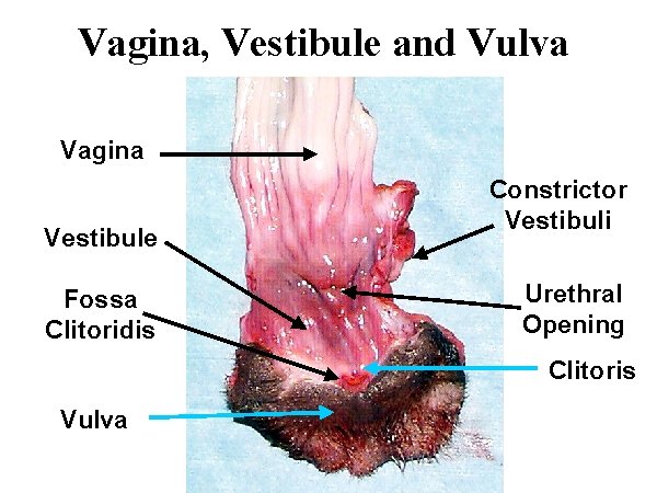 vestibule of vagina