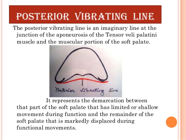 vibrating line