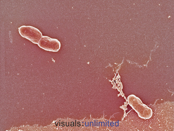 vibrio mimicus