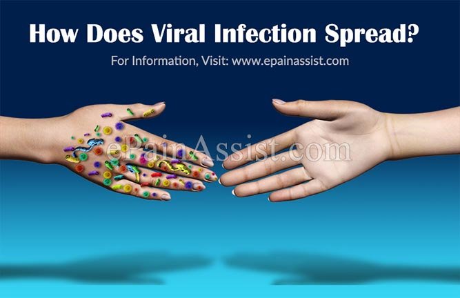viral infection