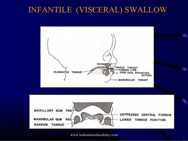 visceral swallow