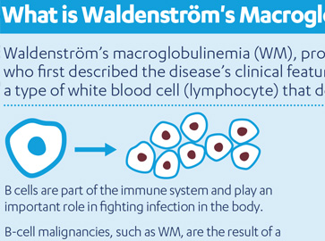 waldenström's macroglobulinemia