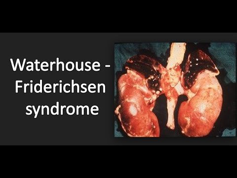 waterhouse-friderichsen syndrome