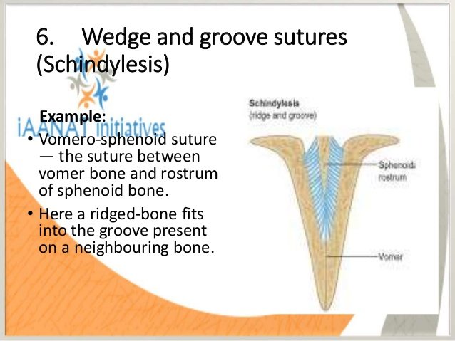 wedge-and-groove suture