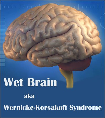 wernicke-korsakoff syndrome