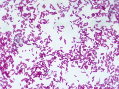 yersinia pseudotuberculosis gram stain bacteria print lm x500 arthur siegelman