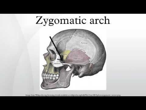 zygomatic arch