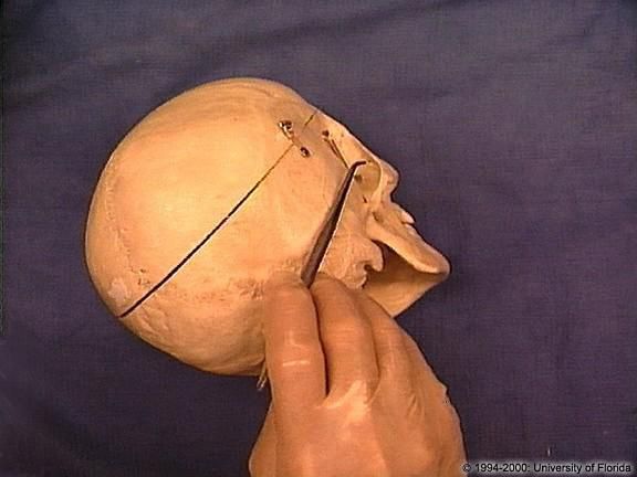 zygomaticotemporal foramen