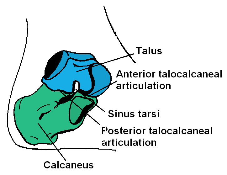 astragalectomy