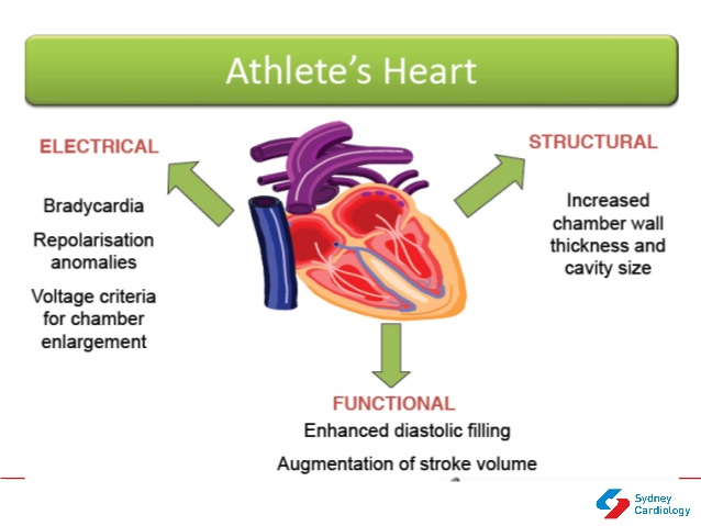 athlete’s heart