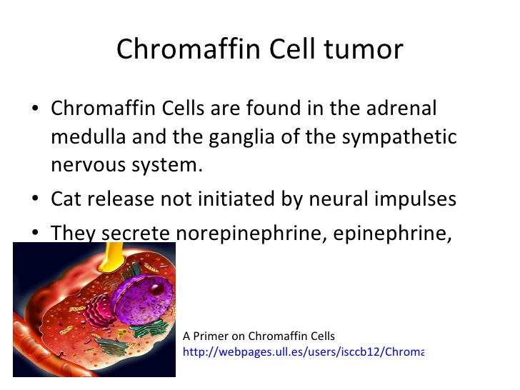 chromaffin tumor