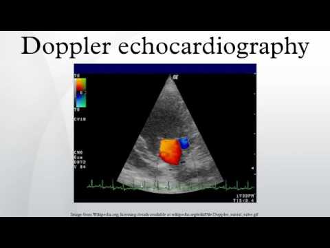 doppler echocardiography