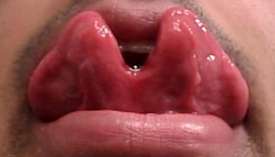 double-tongue