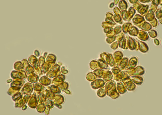 golden-brown algae
