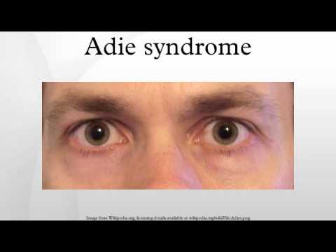 holmes-adie syndrome
