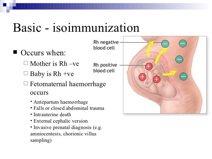 isoimmunization