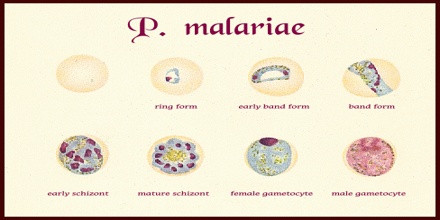malariae malaria