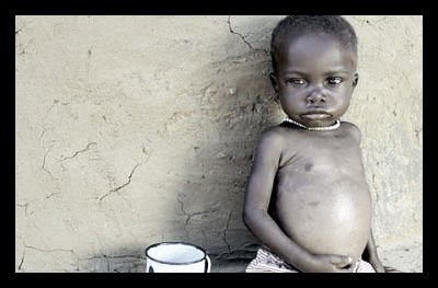 malnourishment