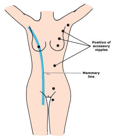 mammary line