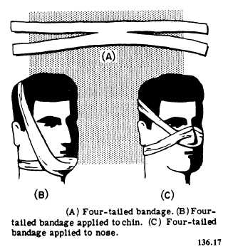 many-tailed bandage