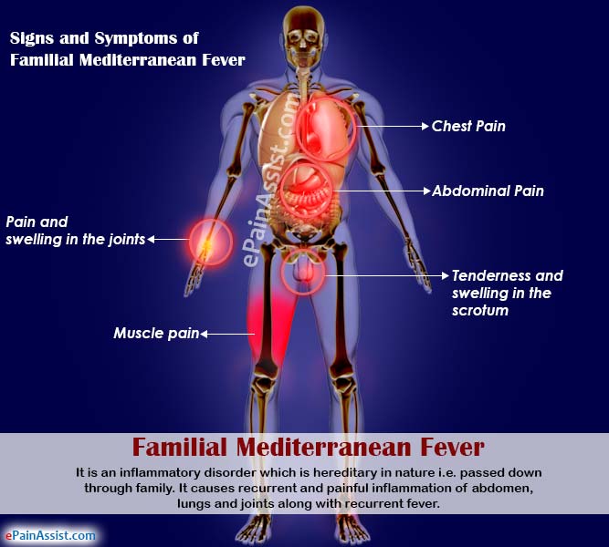 mediterranean fever