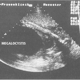 megalocystis