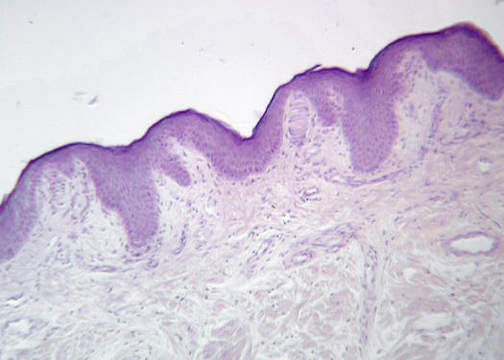 meissner's corpuscle