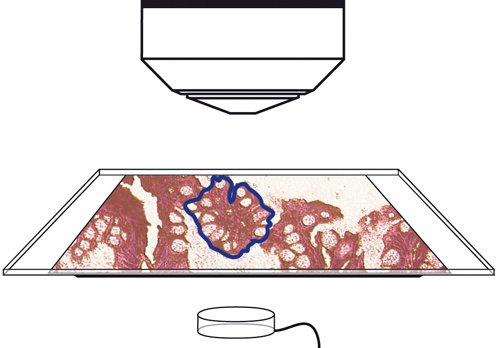 microdissection