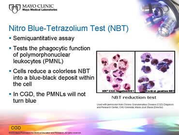 nitroblue tetrazolium test