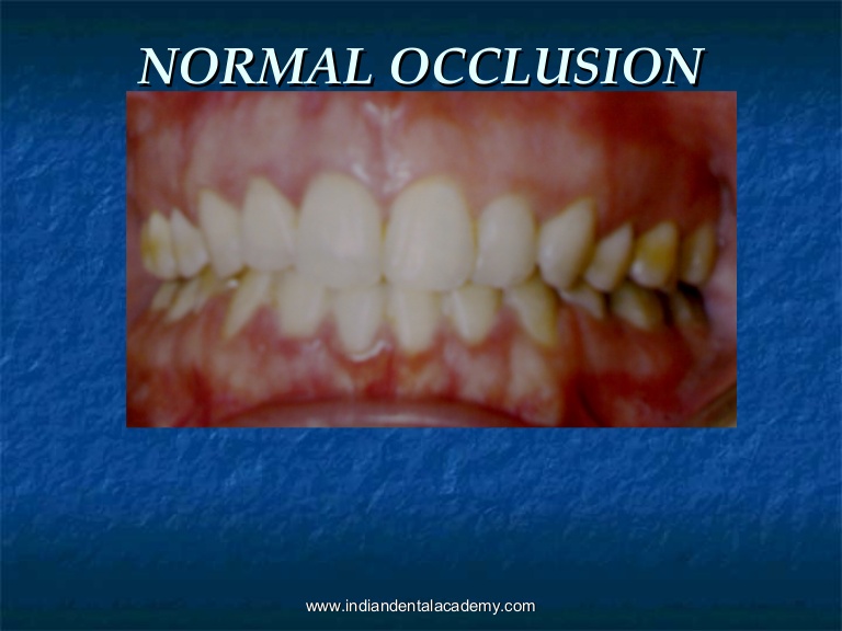 normal occlusion