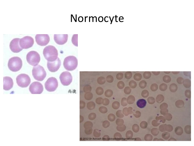 normocyte