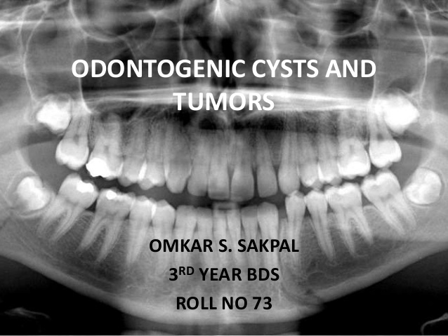 odontogenic cyst