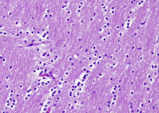 oligodendroglia cell