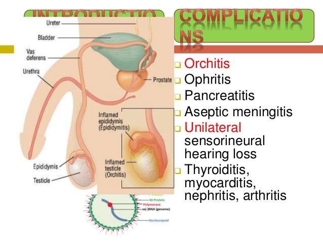 ophritis
