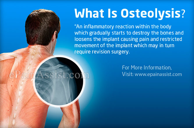 osteolysis