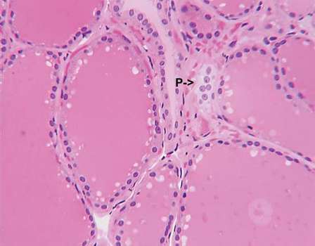parafollicular cell