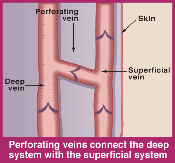 perforating vein