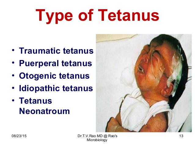 traumatic tetanus