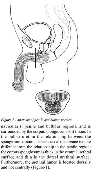 urethroperineoscrotal