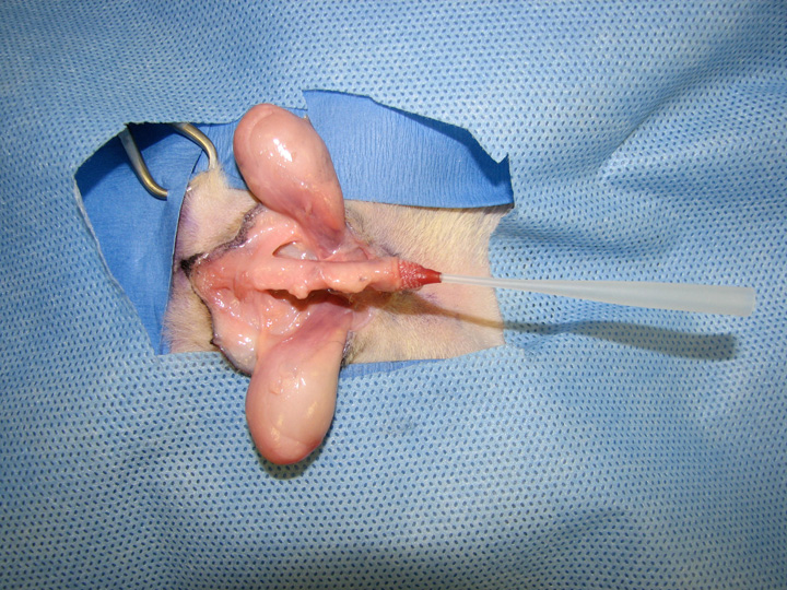 urethrospasm
