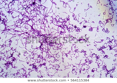 actinomyces