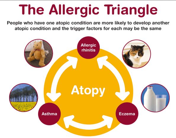 atopic allergy