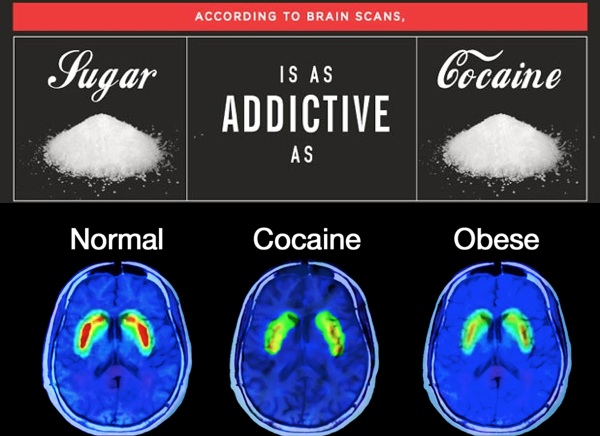 brain sugar