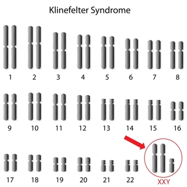 chromosomal syndrome