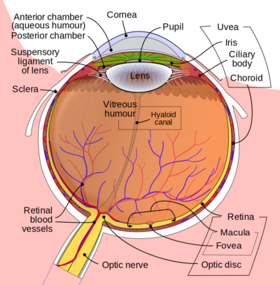 chronic glaucoma