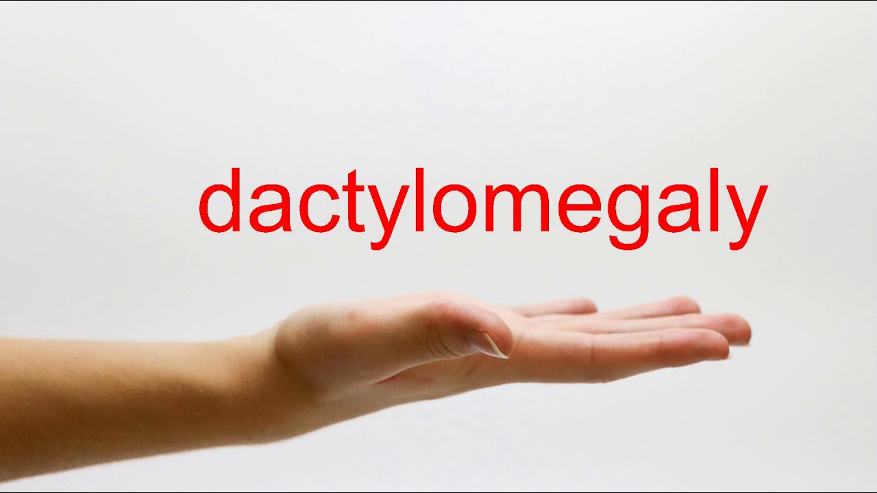 dactylomegaly