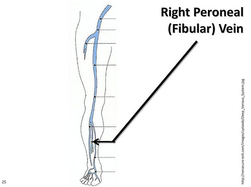 peroneal vein