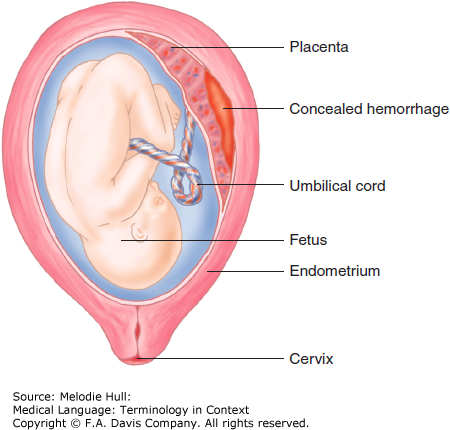 uteralgia